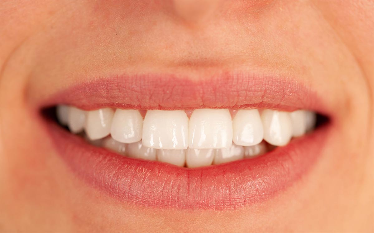 Foto von lächelndem Mund mit schönen Zähnen